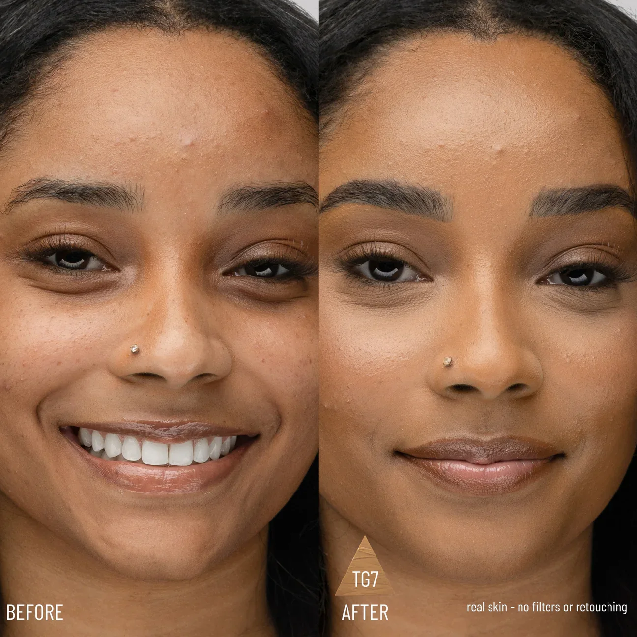 Confident Complexion Duo - Image 4